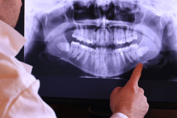 Best Emergency Tooth Extraction in Woodland Beach, MI